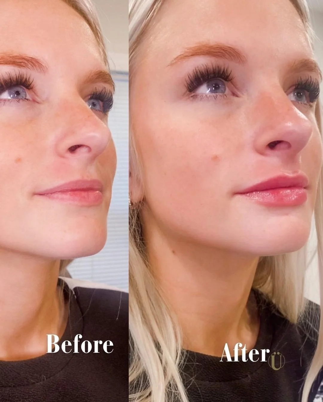 Is it the Christmas spirit, or is it a little holiday magic? 😉 lips are ready for all the mistletoe kisses this year! Let your family guess the source of this extra glow this Christmas Eve. ✨