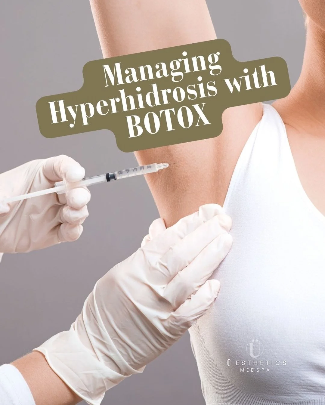 Tired of ruining your favorite clothes with sweat stains? Or feeling that panic when you raise your arms in a meeting? You&rsquo;ve tried clinical deodorants, and they don&rsquo;t work. We get it.
Stop the sweat at the source. Botox for Hyperhidrosis