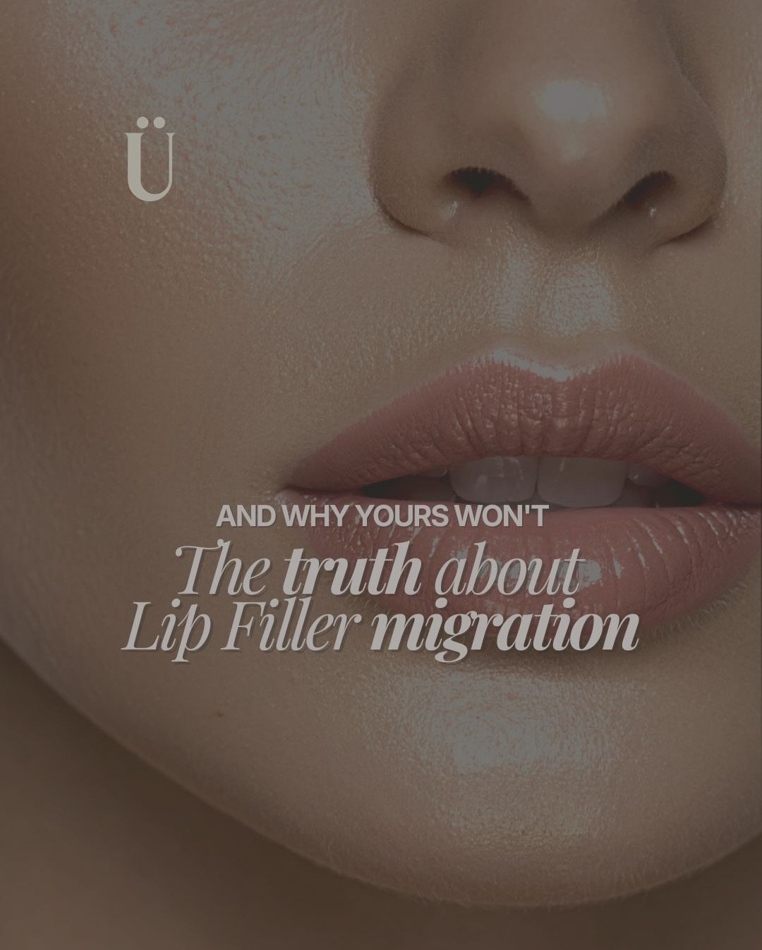 The truth about migration.🔍👄
Migration isn&rsquo;t an inherent flaw of the product; it&rsquo;s usually a flaw of technique. When too much volume is introduced too quickly, it loses its structural integrity and searches for space outside the natural