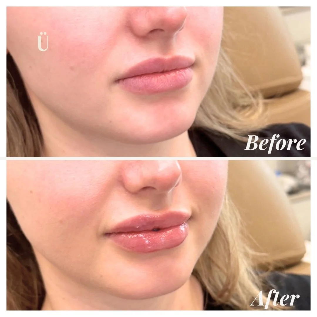 The goal is for them to notice, but never know. 🤫✨
Refined, steady, and entirely you. We don&rsquo;t do &ldquo;cookie-cutter&rdquo; shapes. We look at your unique canvas and enhance what&rsquo;s already there.
The result? A profile that feels balanc