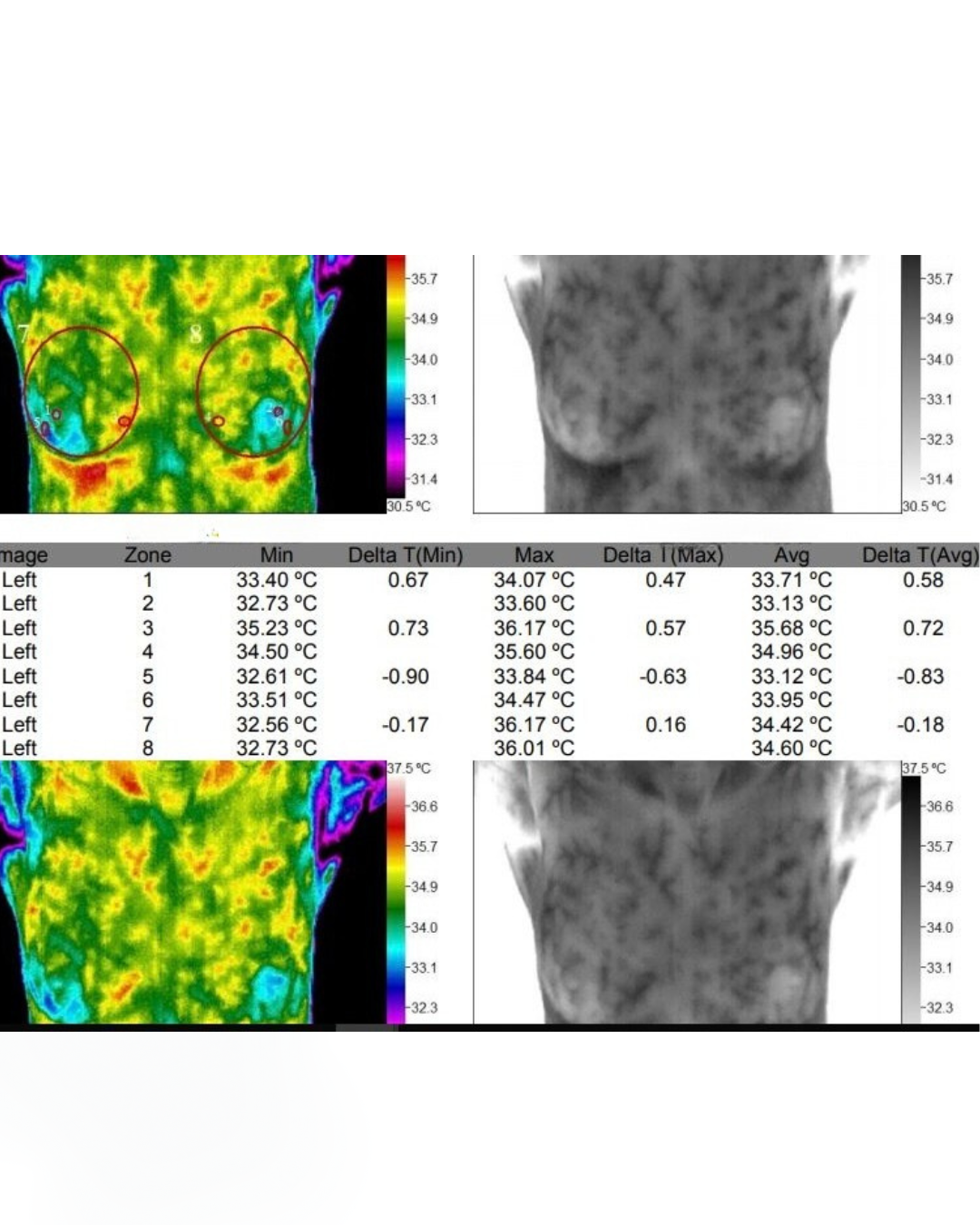 Thermal images and temperature readings of a person's chest and shoulders from different angles, showing heat patterns and temperature measurements.