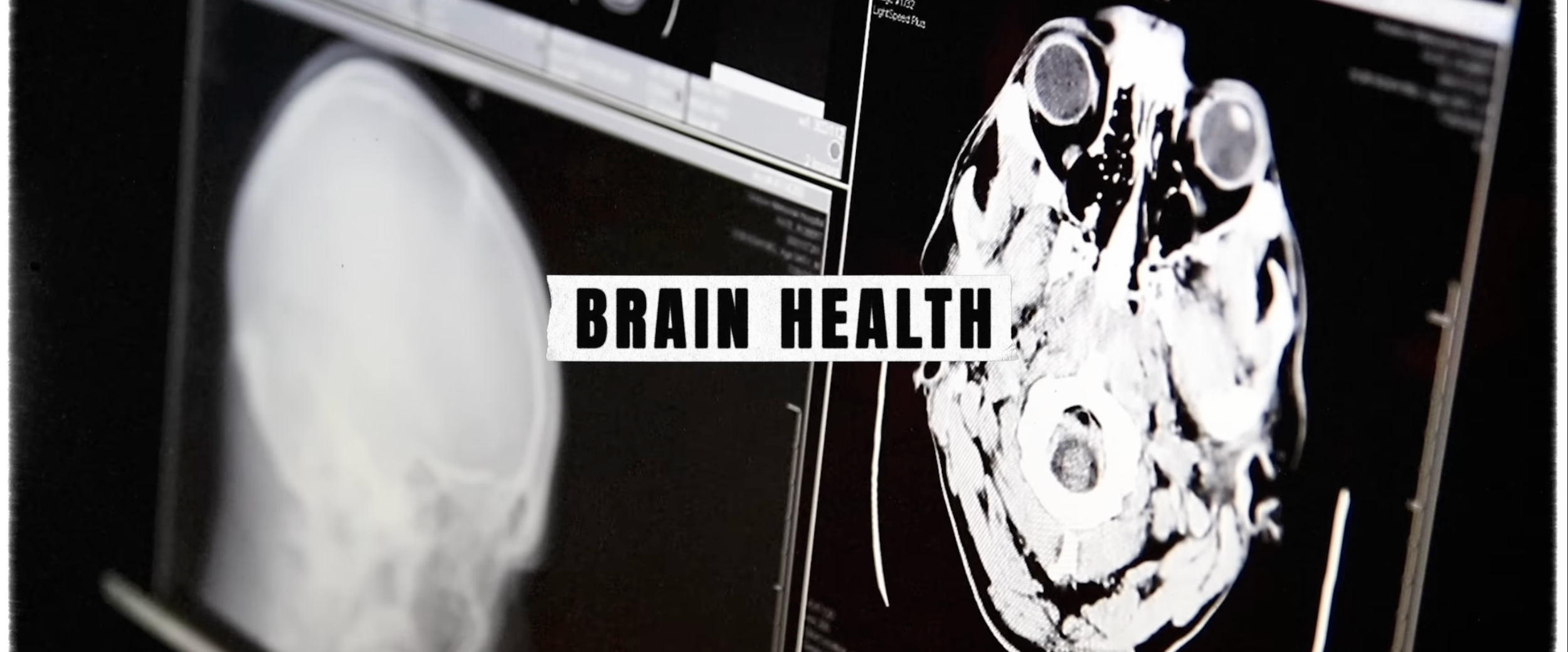 Isn't fish a health food?