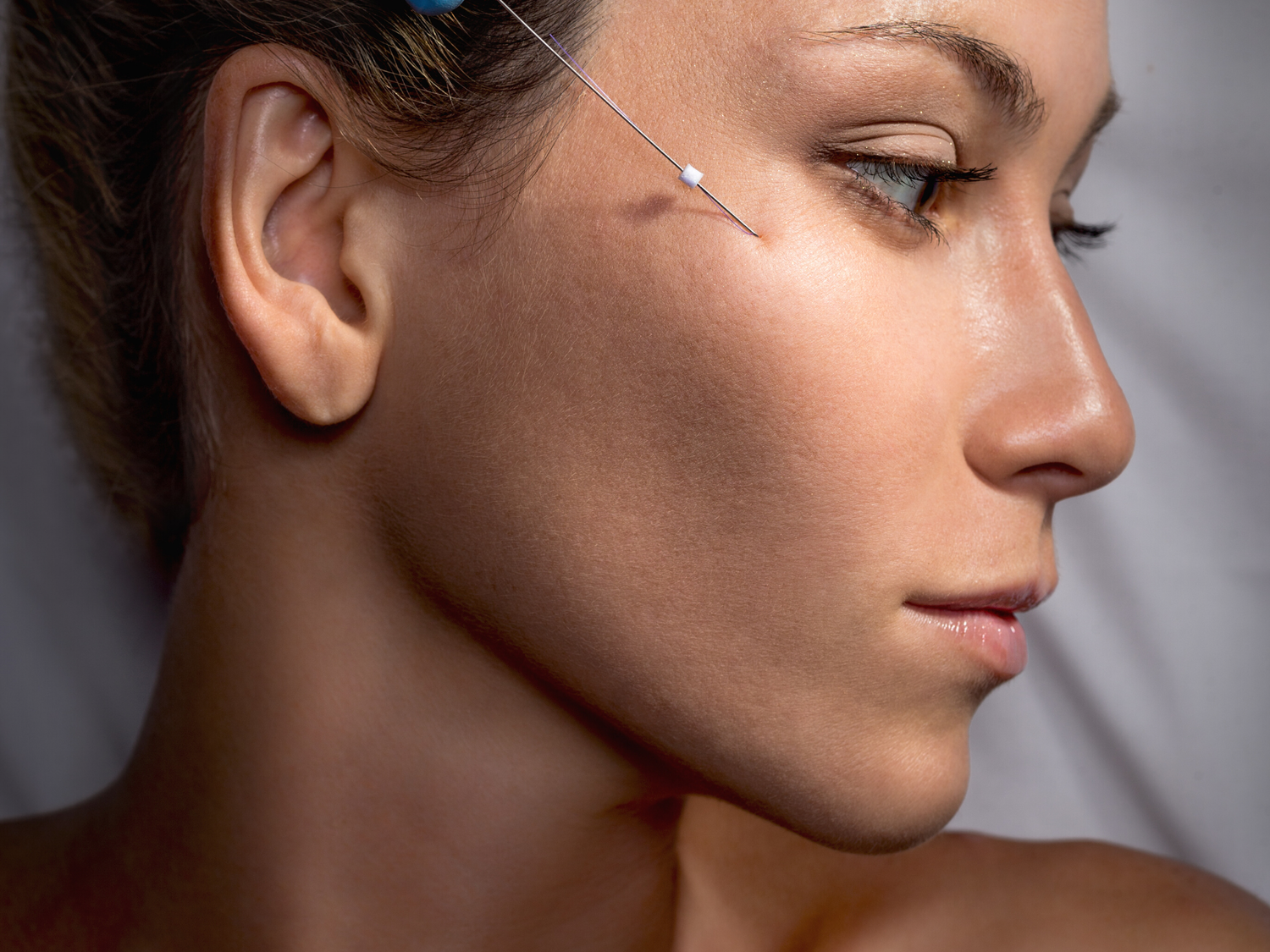 PDO Thread Lift — Beauty Lounge Med Spa