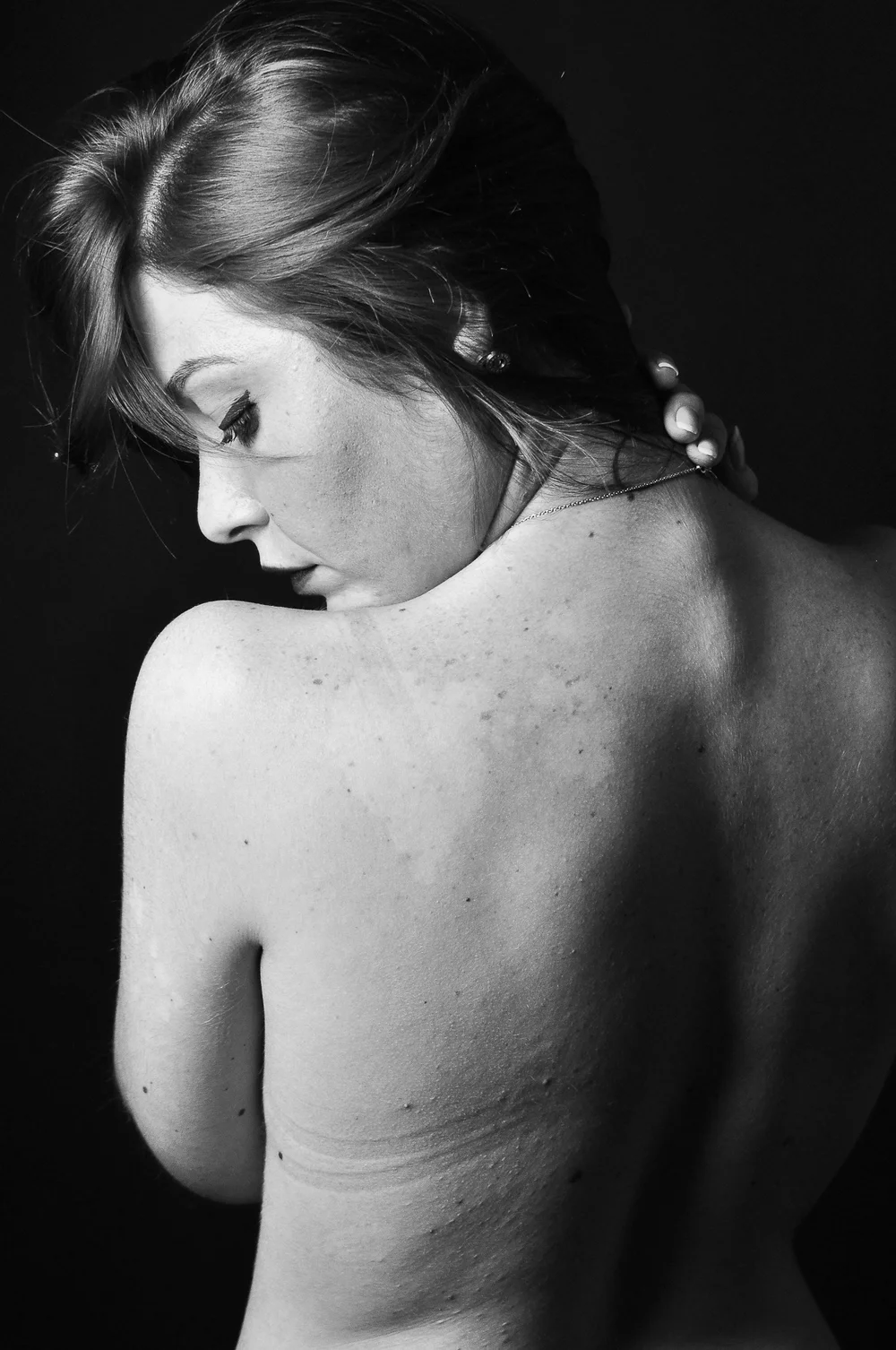 Acupuncture for Back Pain — Stardust Wellness | Acupuncture & Herbal ...