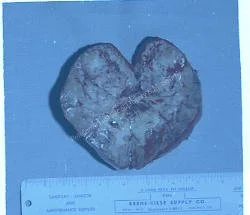 1979-80-008.jpg