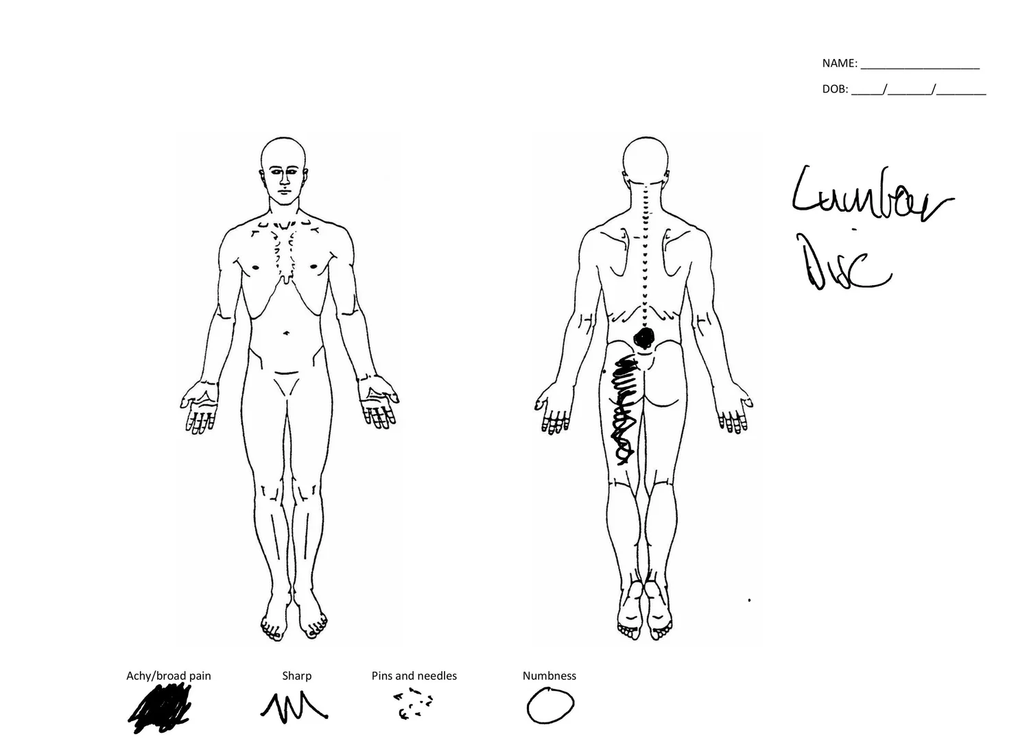 Pain Treedraw Pain Pattern — Dr. Dan Bates