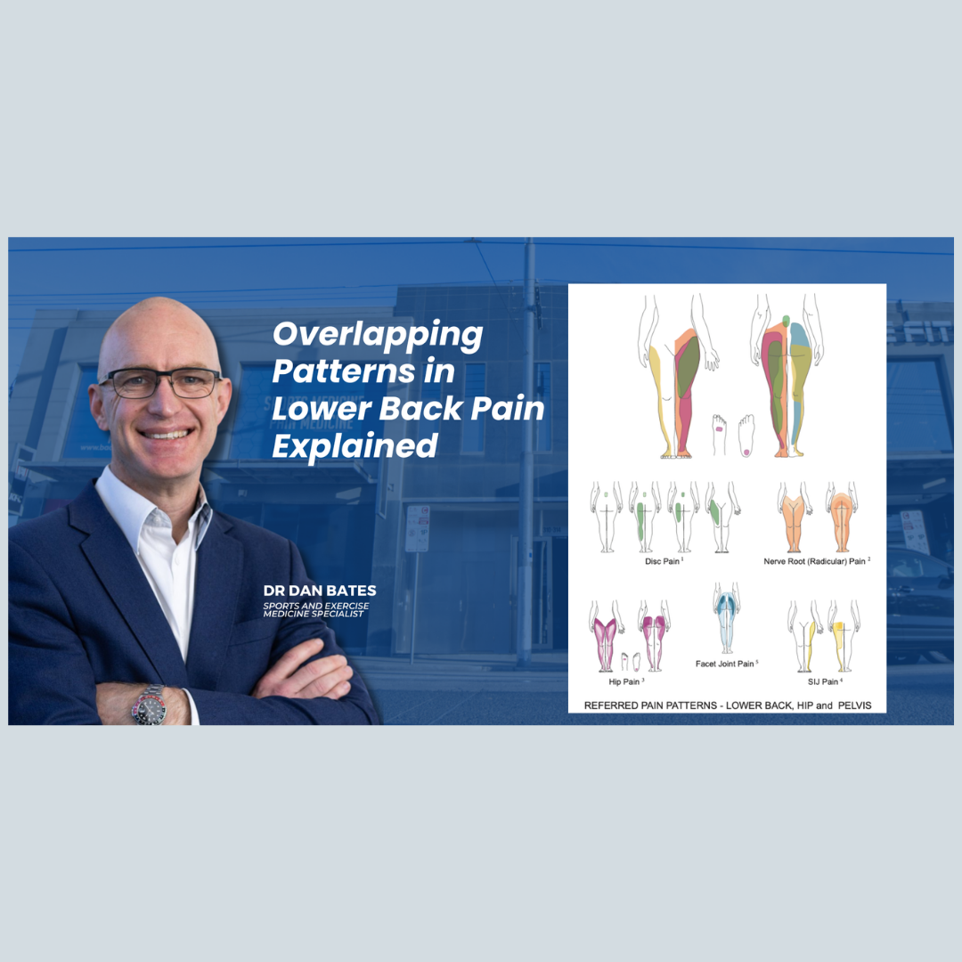 Overlapping Causes of Lower Back Pain Explained