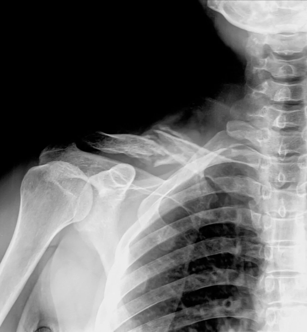 Discogram | Discover Pain Relief Options — Dr. Dan Bates