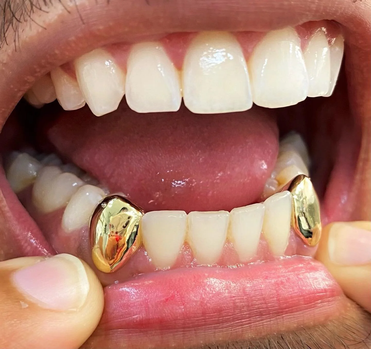 POPUP GRILLZ — WILD SMILES