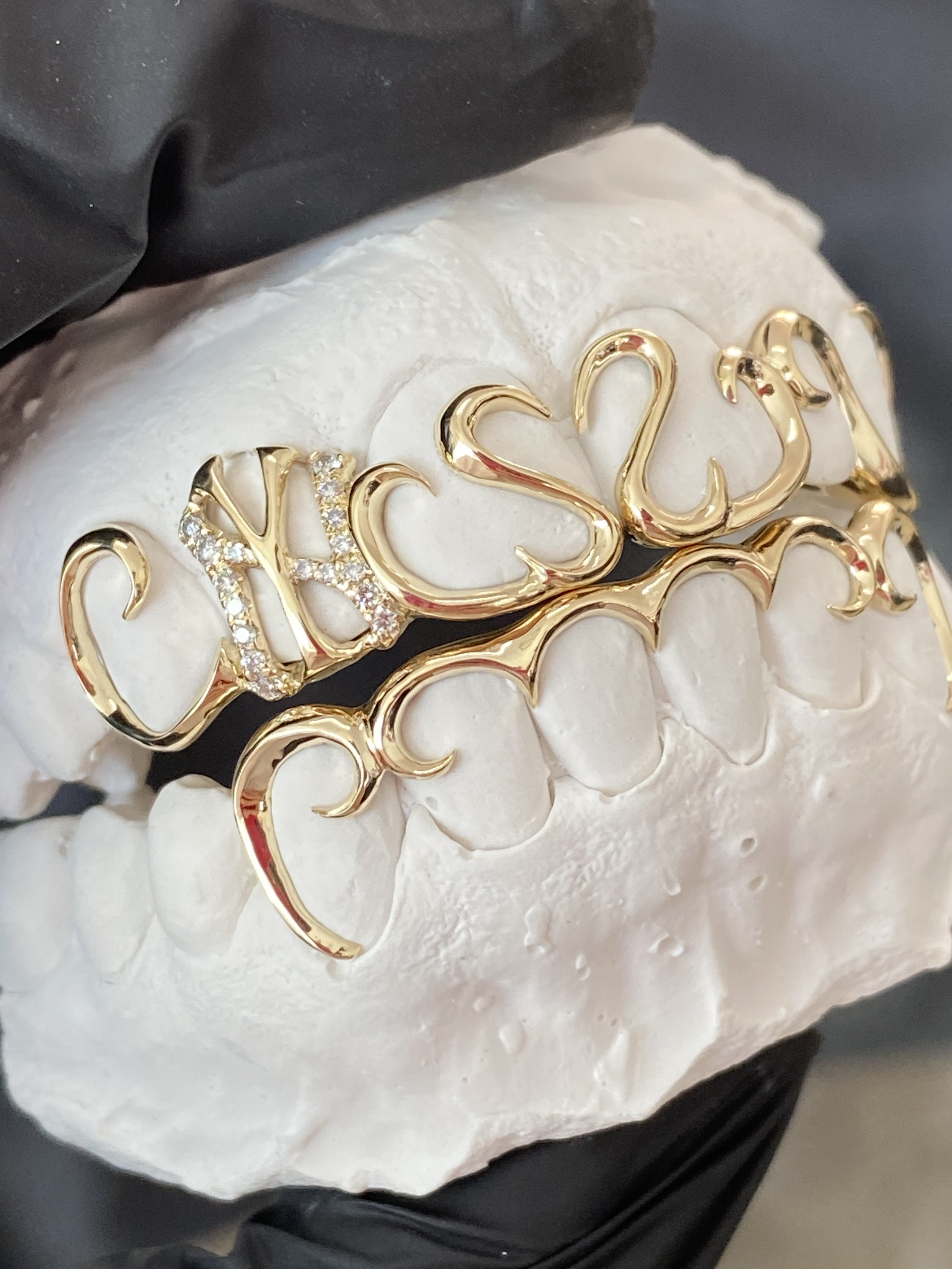 GOLD SWIRL GRILLZ