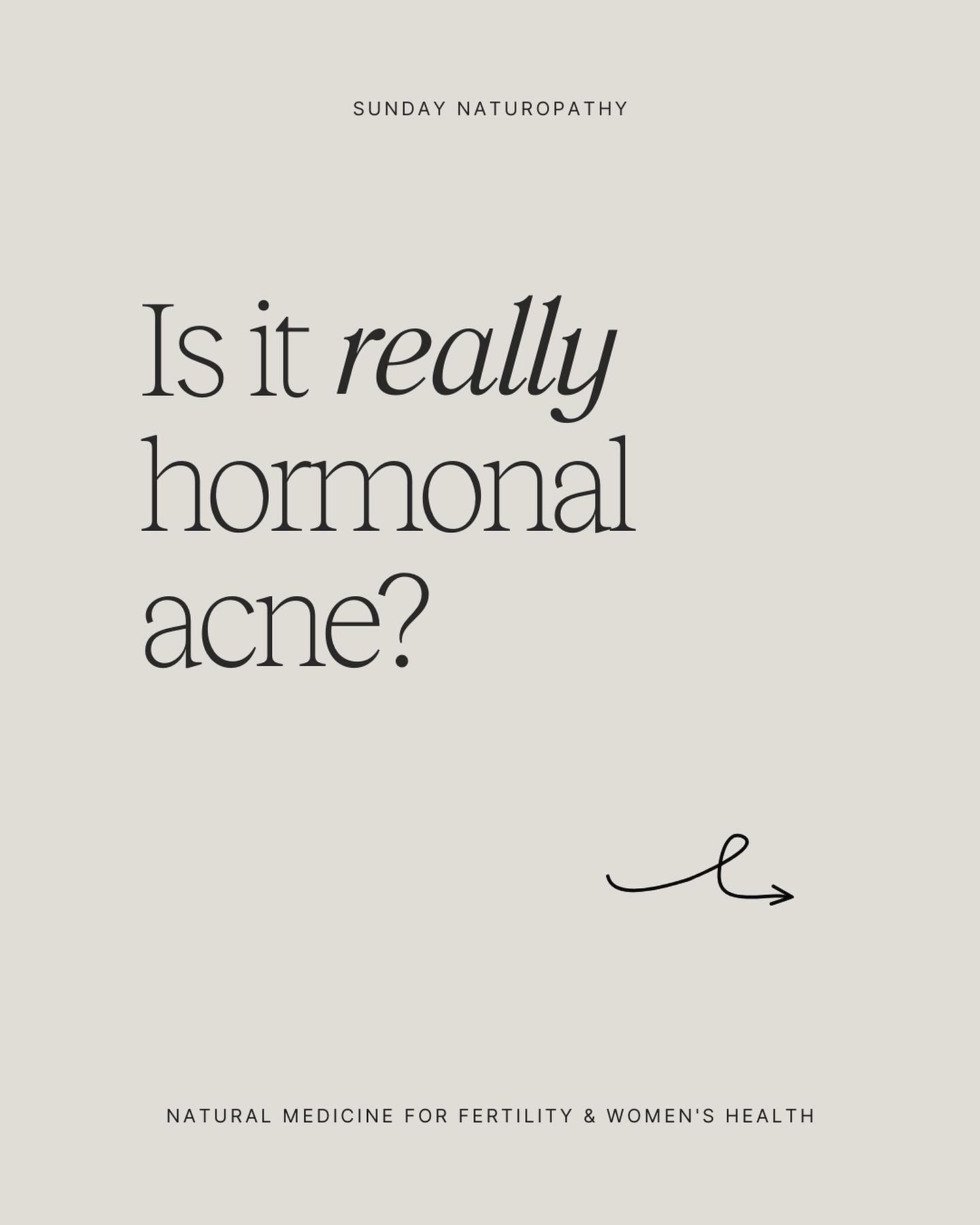 Spoiler alert: acne isn&rsquo;t always caused by hormones. The gut (in more ways than I could possibly hope to explain in this caption) is often the root cause of skin woes. 

Look for these clues:

&mdash; You&rsquo;ve tried a contraceptive pill, an