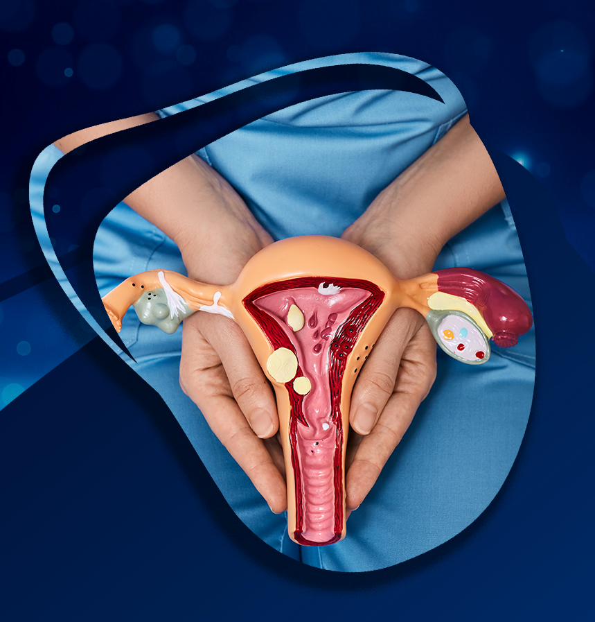 Exploring a New Approach to Period Pain: Our Fascial Manipulation® Pilot Study