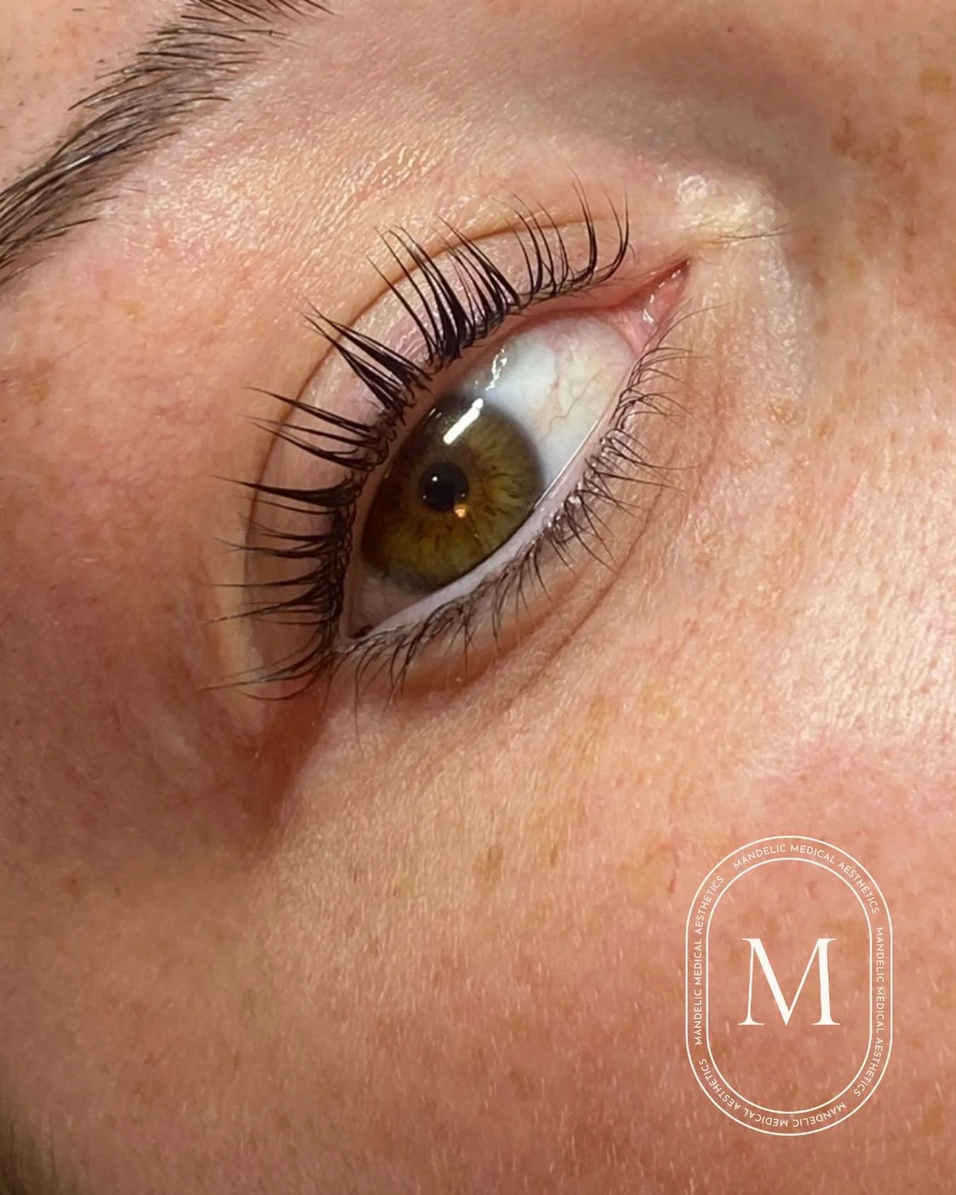 A close-up of the dreamiest lash lift + tint by Marissa 💕

#lashes #liftandtint #mandelicmedicalaesthetics #waterfordontario #norfolkcountyontario #lashlift
