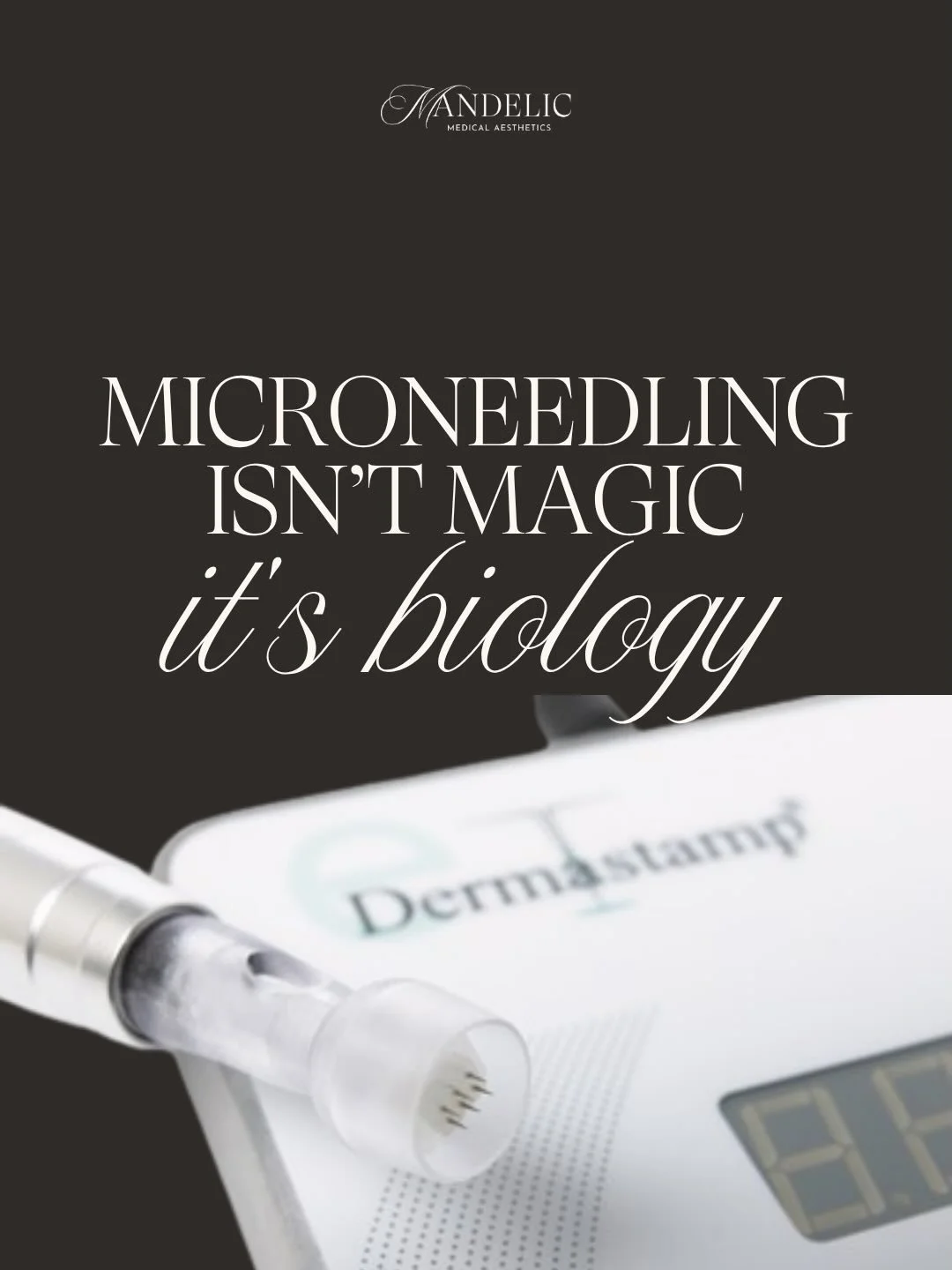 Microneedling is one of the smartest things you can do for your skin.

It creates tiny, controlled micro-injuries that tell your body, &ldquo;Hey, repair this!&rdquo;

The results aren&rsquo;t instant and that&rsquo;s the point. They build slowly, na