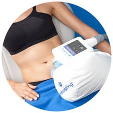 CoolSculpting Baltimore, MD, Owings Mills