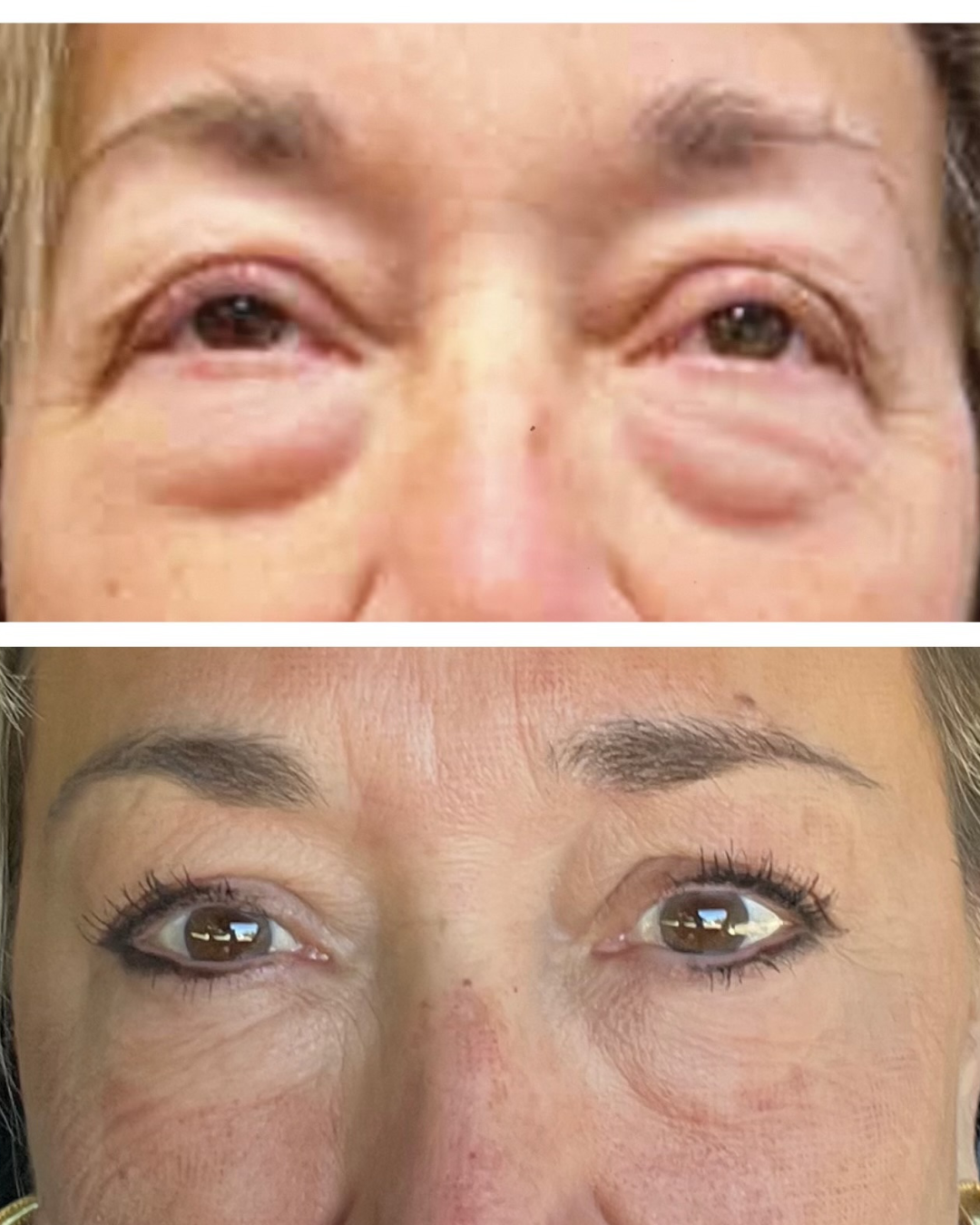 Tixel Before and After.png