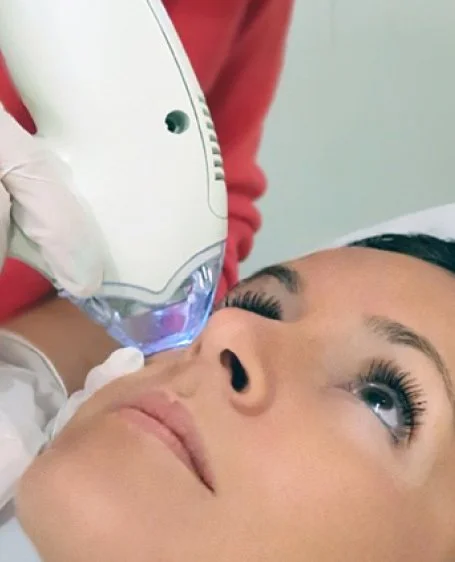 Tixel Skin Resurfacing