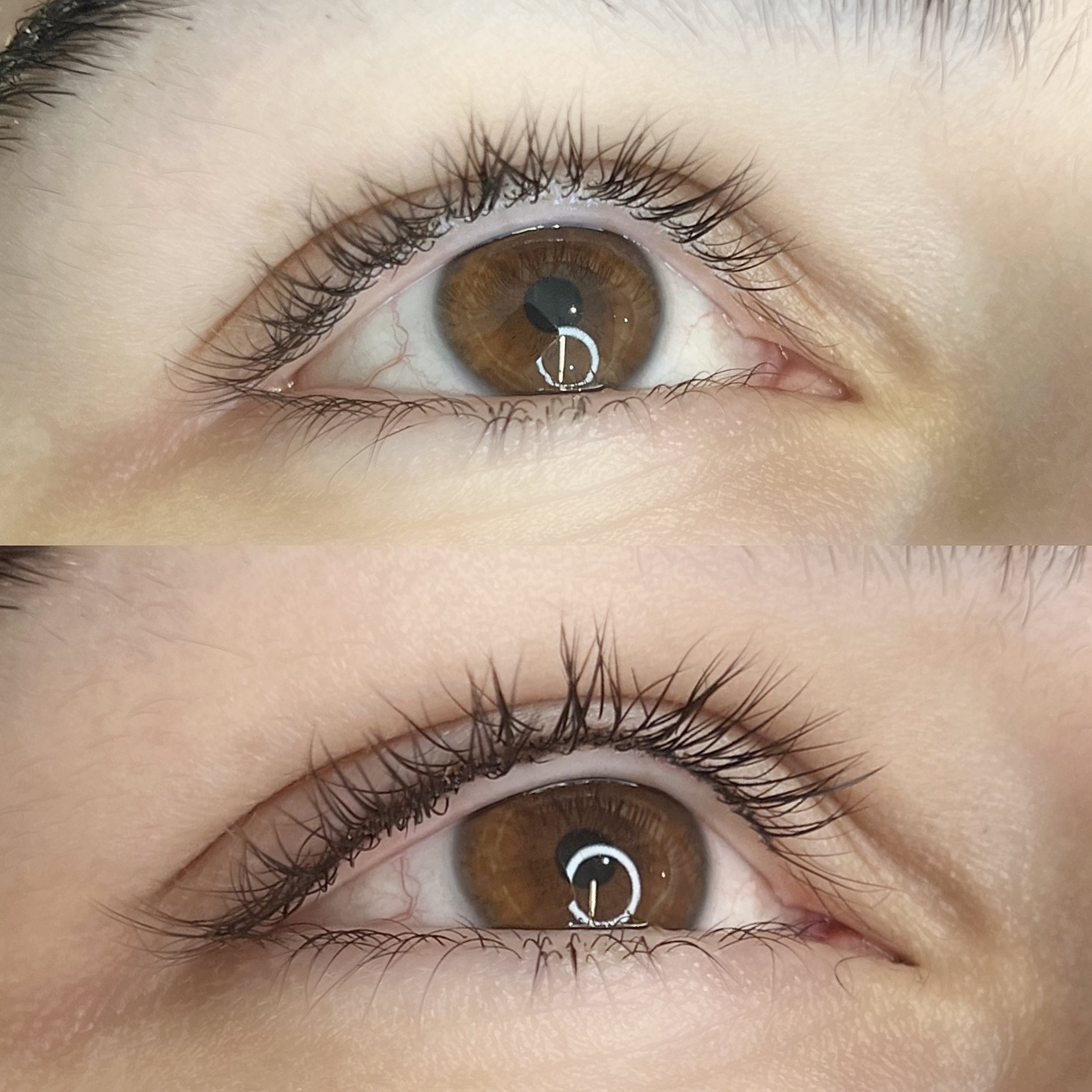 Under Eye Concealer Tattoo - Does It Work and Is It Safe?