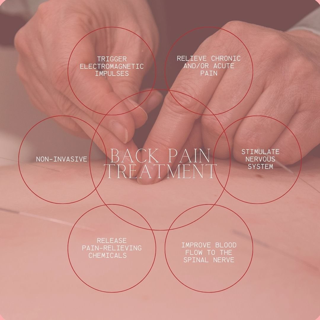 Treating back pain with acupuncture is effective, simple, and quick. Whether it is acute or chronic back pain, Middleburg Acupuncture &amp; Apothecary can help you 🌿

Schedule a complimentary consultation and/or book your initial or subsequent acupu