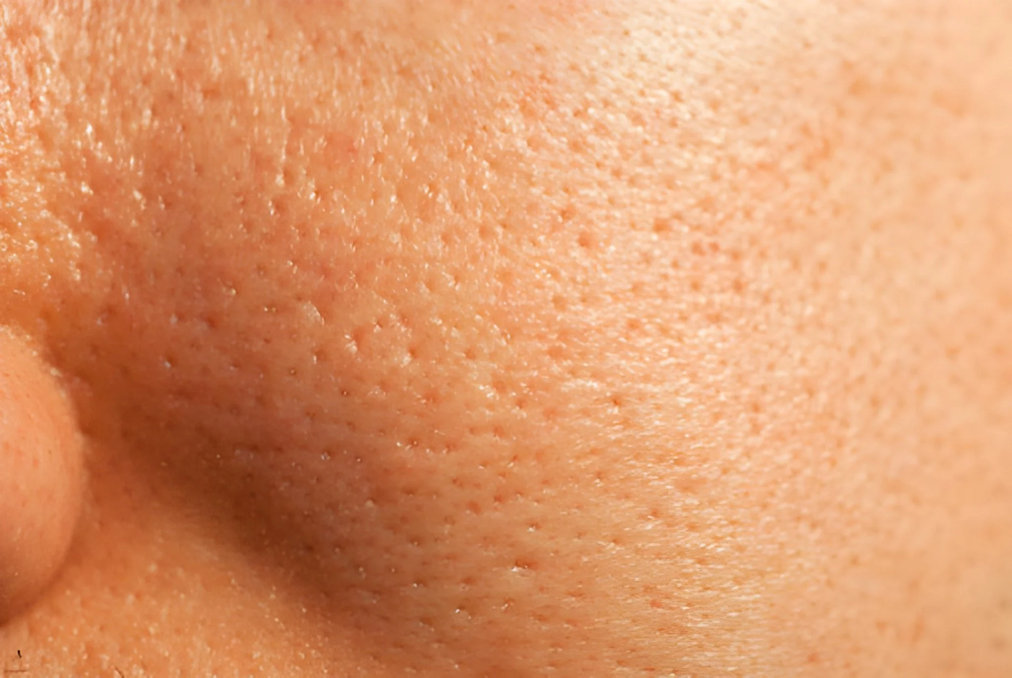 Beyond the Surface: Understanding and Minimizing Large Pores