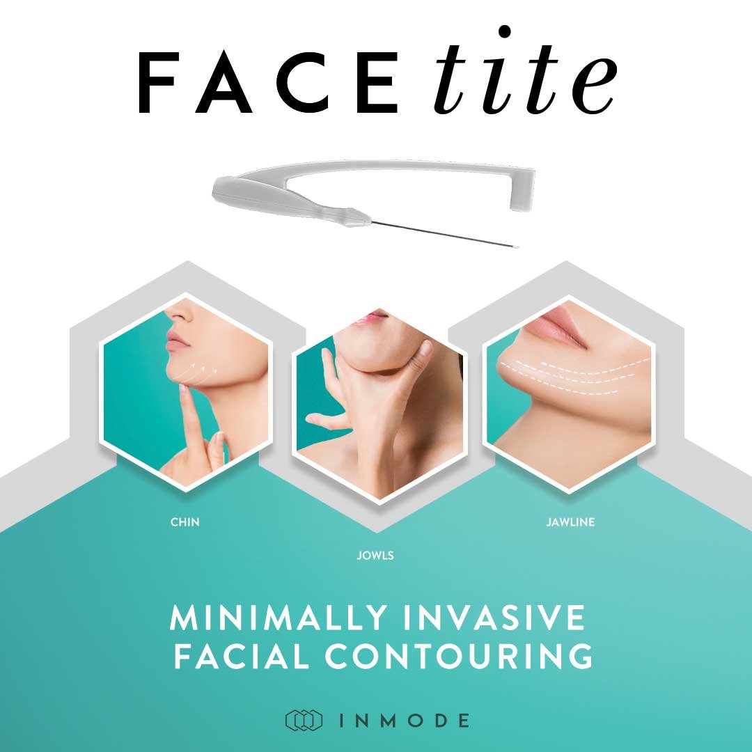 FaceTite™ Face Contouring for Men - Vie Aesthetics