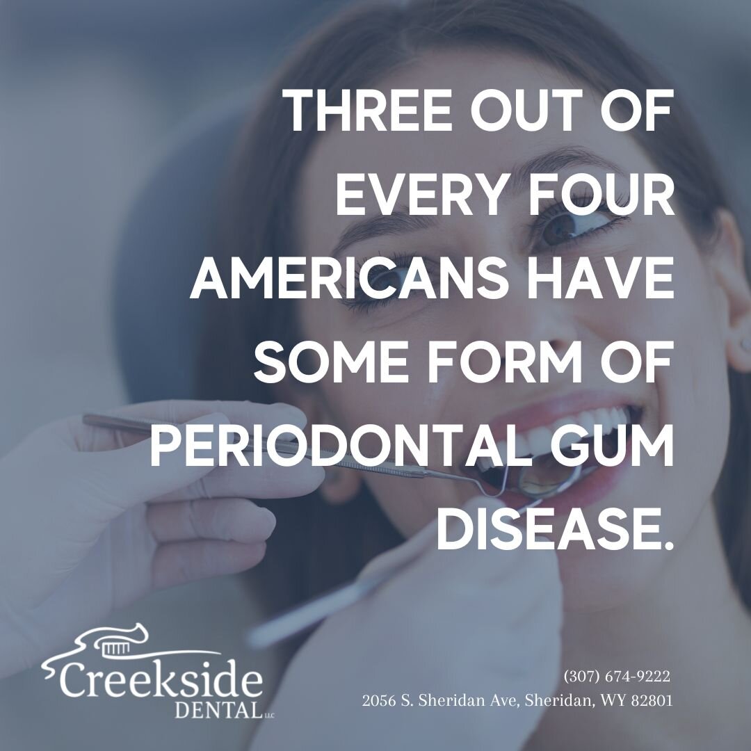 3/4 of Americans have a periodontal disease. The American Academy of Periodontology (AAP).

Creekside Dental prioritizes the health of our patients through practices like these. Schedule your appointment today! Preventative care is better than diseas