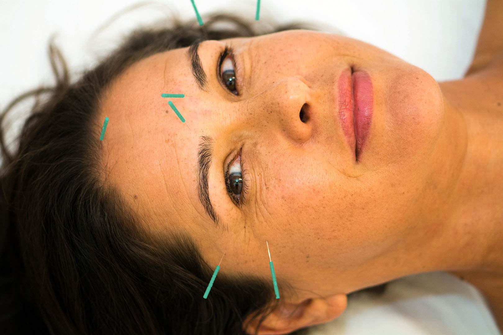 acupunctureblogessentialmedicinenaturalhealthlajollasandiego1.jpg