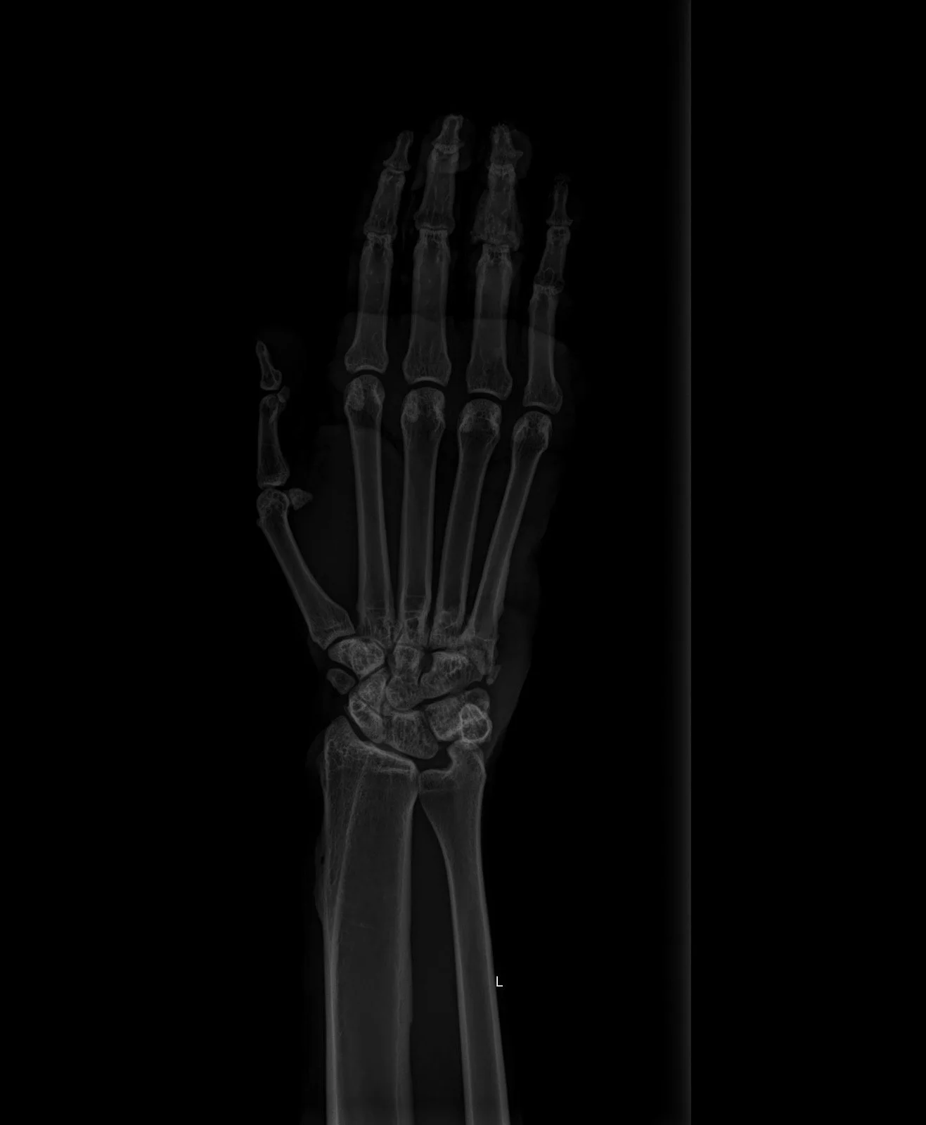 A New X-Ray Machine for Our Veterinary Clinic