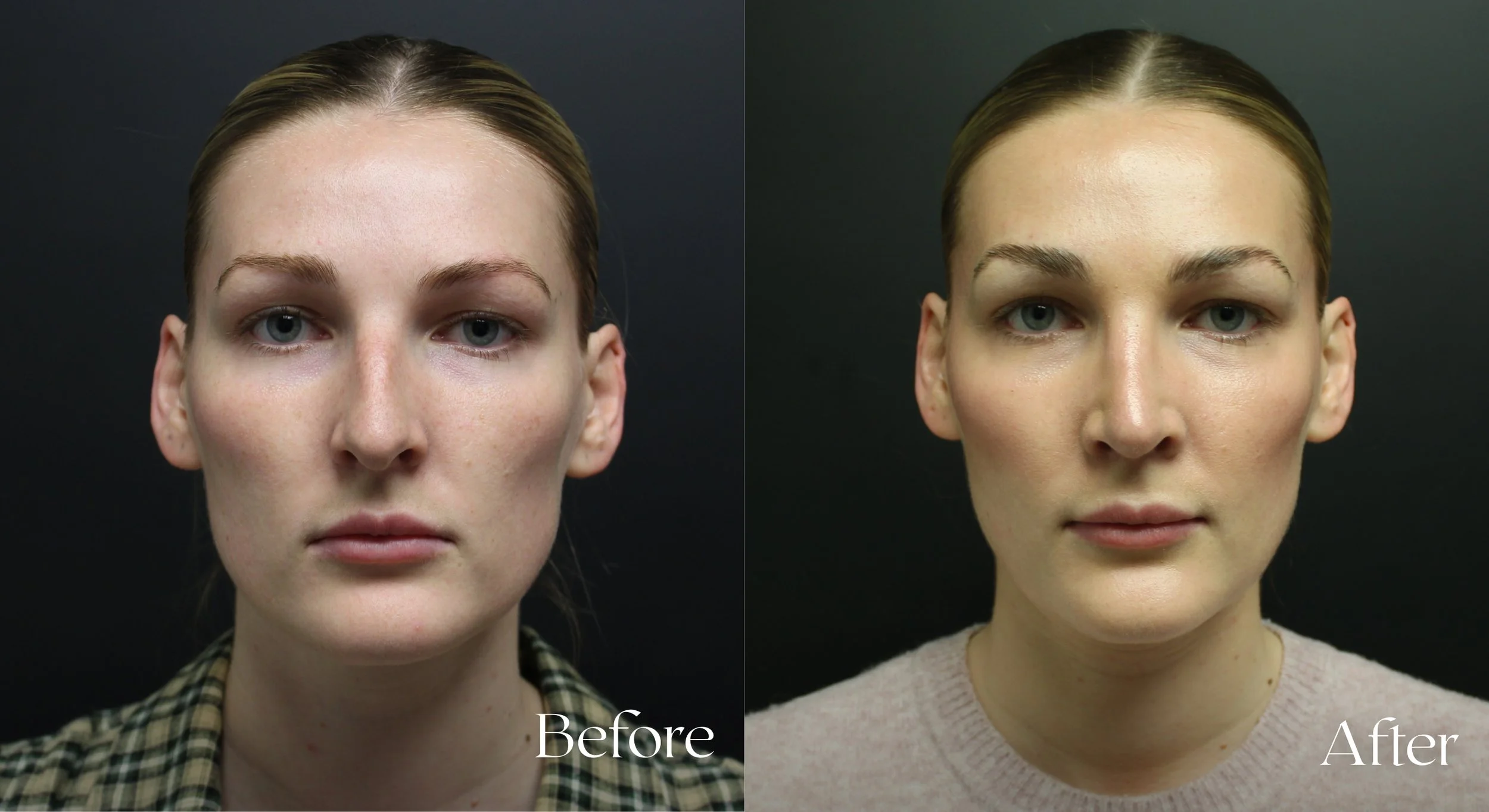 Before and After Front.jpg