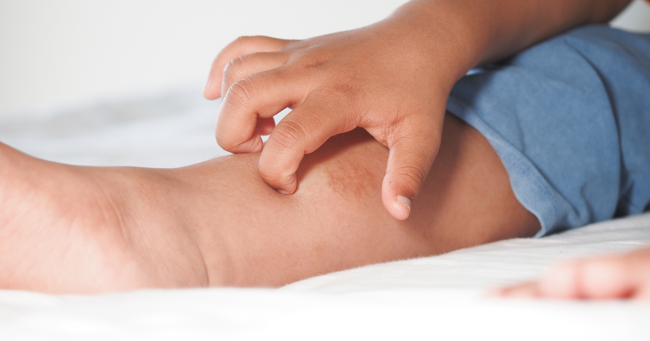 When Spring Hits the Skin