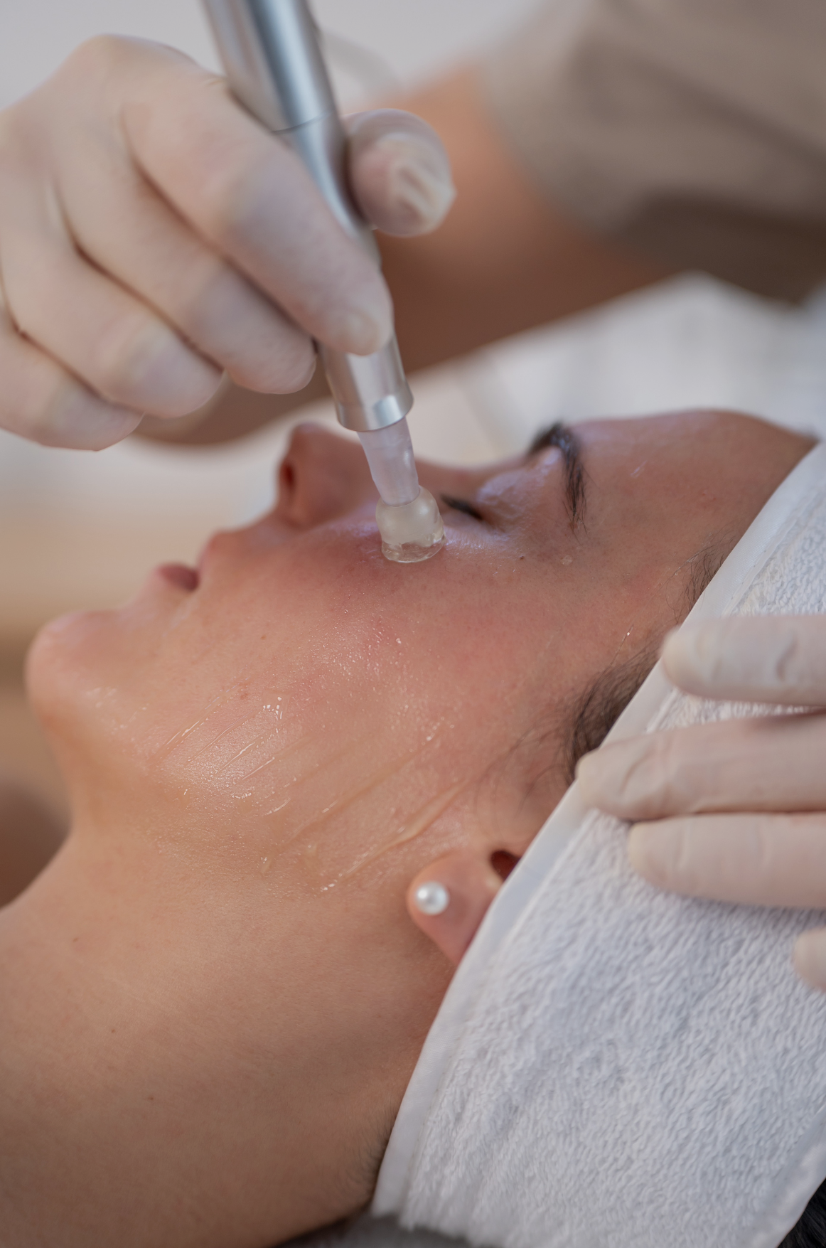 A person receiving a skin needling with a device applied to their forehead and nose, lying down with a white headband and a towel around their neck.