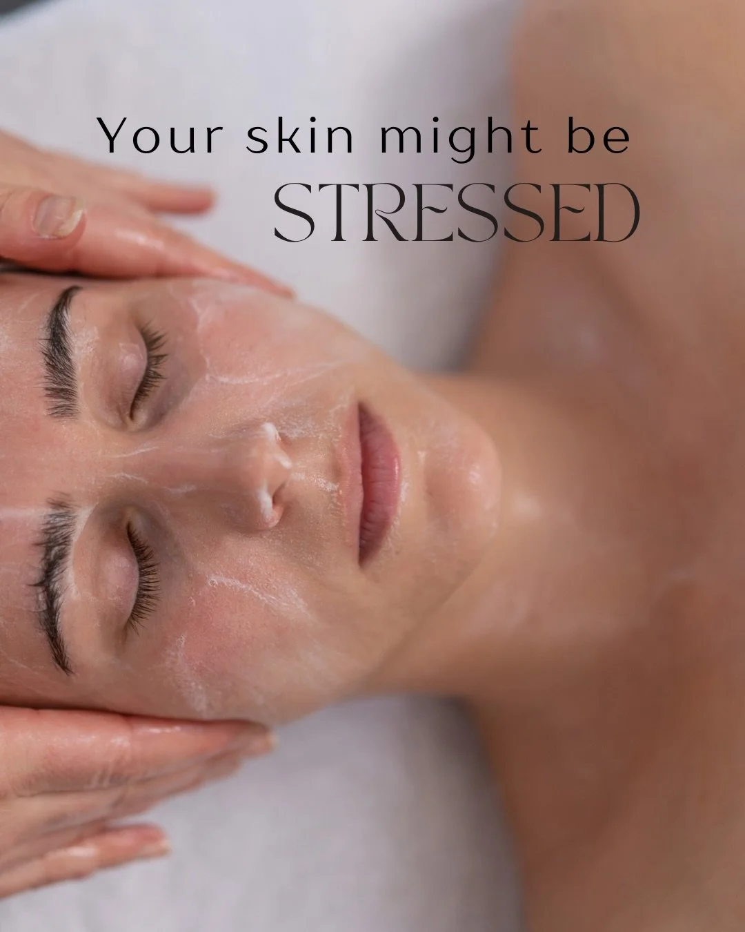 Your skin feels everything you don&rsquo;t say out loud.

One of the biggest things I see in clinic is skin that isn&rsquo;t just reactive ... it&rsquo;s stressed.

When the nervous system is overwhelmed, the skin often shows it through:
&bull; Break