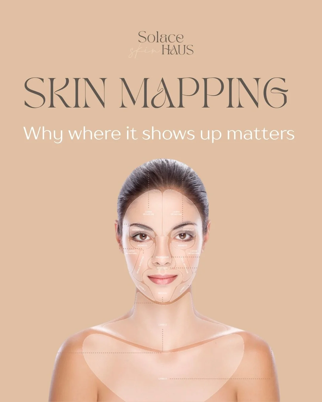 Ever feel like your skin is &ldquo;acting up&rdquo; for no reason?

This is exactly why I use Skin Mapping.

It helps us connect what&rsquo;s showing up on your face to internal patterns that may be driving it.

Quick note: the Skin Map is a guide, n