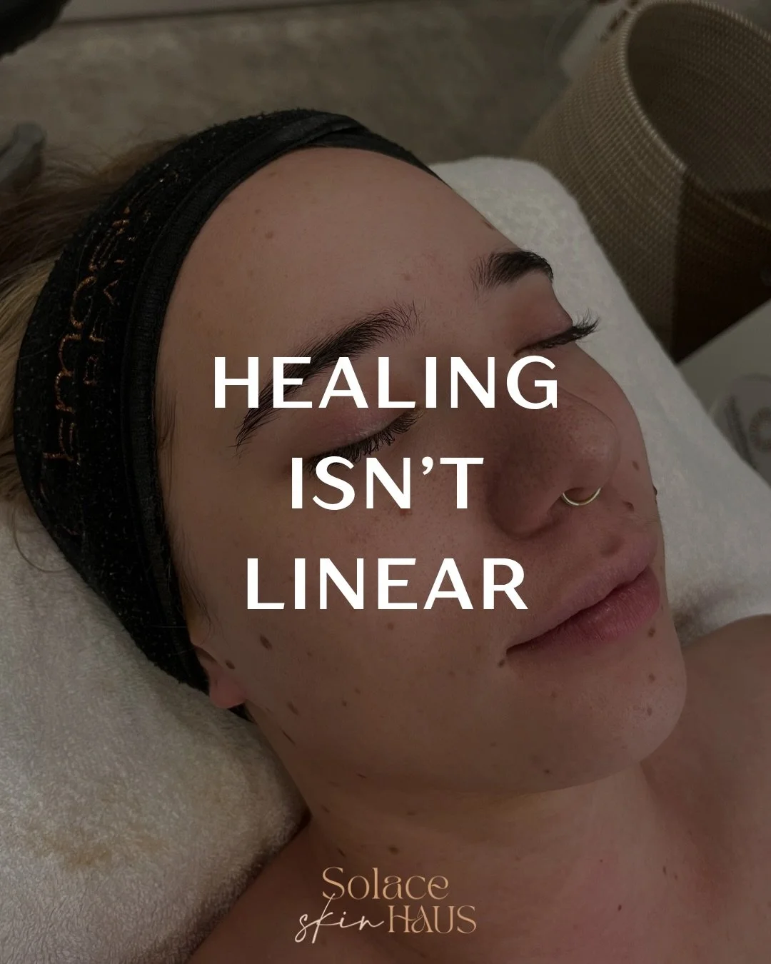 Healing isn&rsquo;t linear.

This is one of my favourite reminders for reactive, inflamed skin&hellip; because progress can look like:

1) A flare that feels loud and uncomfortable
2) A calm stretch where your skin starts to soften and settle
3) A li