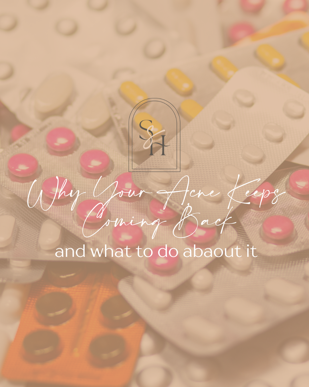 Why Your Acne Keeps Coming Back (And What to Do About It)