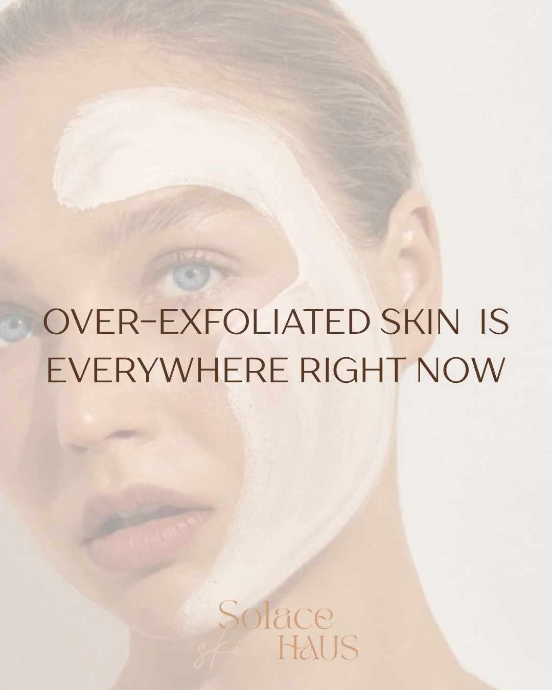 If exfoliation is stinging, peeling, or making you flush...

It is not &ldquo;working&rdquo;.
It is inflaming your barrier.

If your skin is reactive, inflamed, or breaking out, I choose enzymes over AHA/BHA&rsquo;s because they are non-inflammatory 