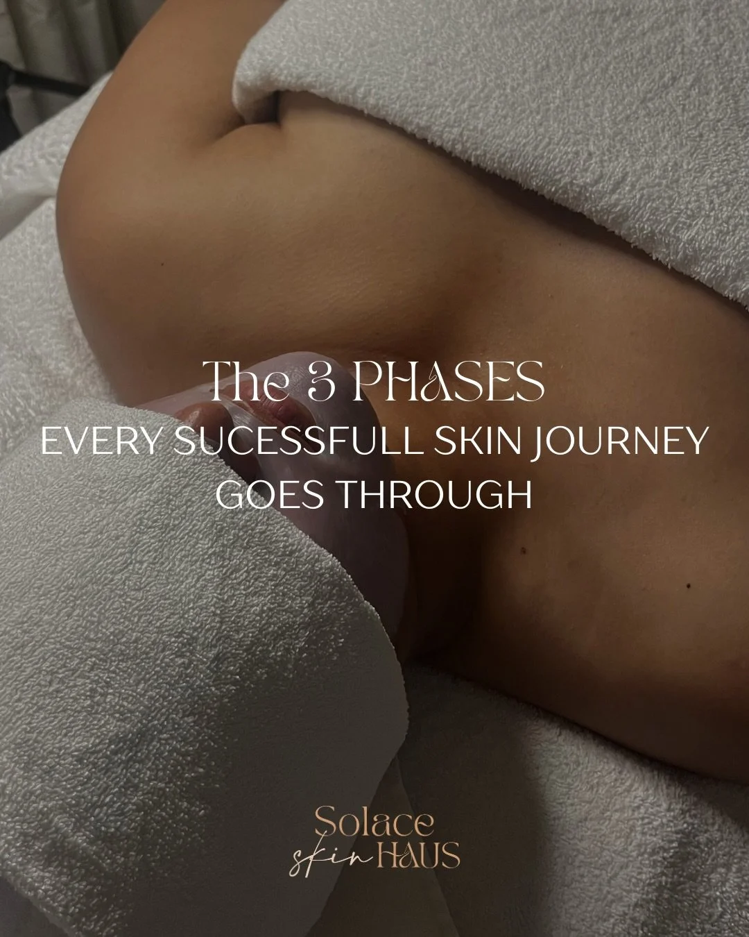 The 3 phases every successful skin journey goes through ✨

One of the biggest misconceptions in skincare is that transformation happens in a straight line.

In reality, healthy skin is built in phases.

Before we can focus on correcting concerns, we 