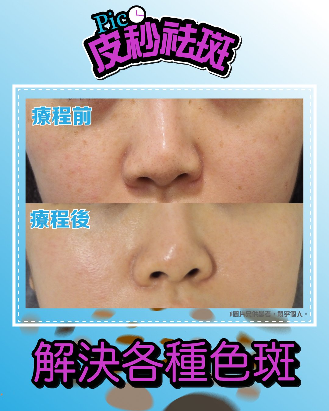 BL_FT28前後圖.jpg