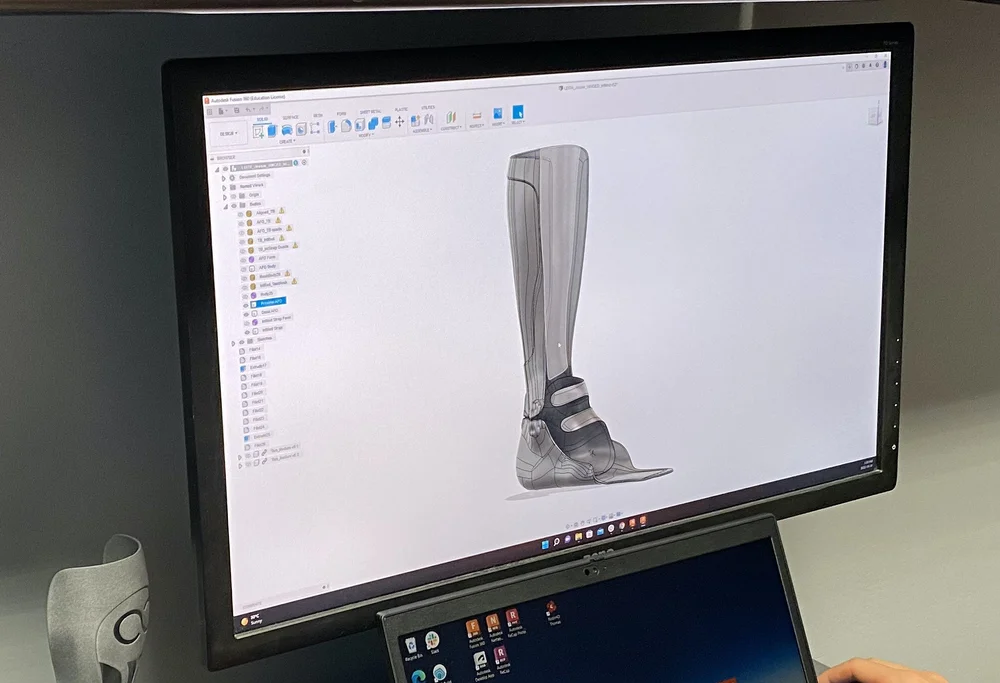 Future of orthoses - Boundless Bracing-3d-printing — Boundless ...