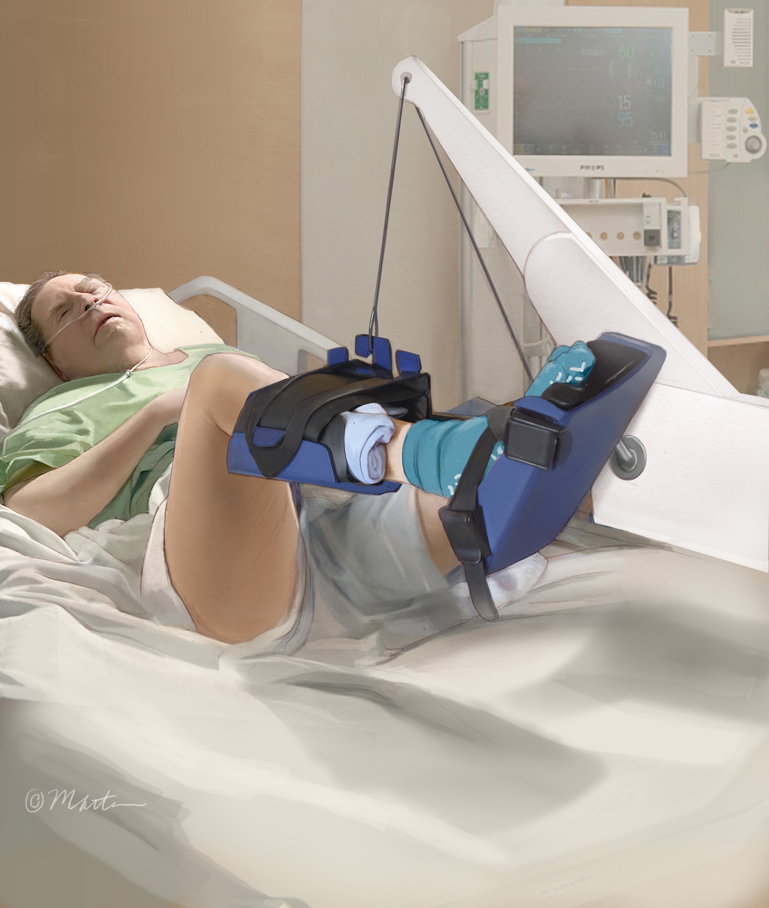 Early Mobility Interventions