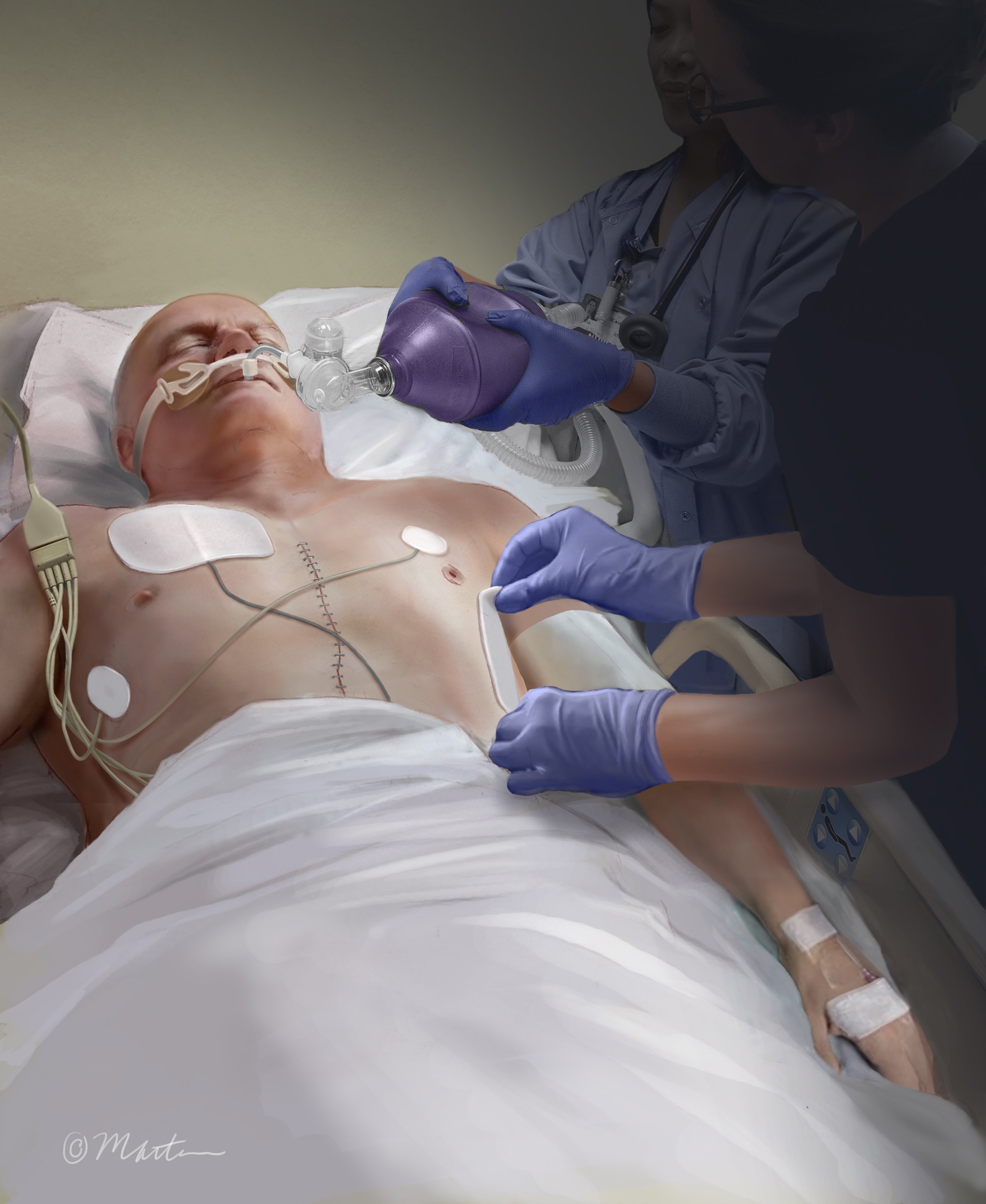 Resuscitation
