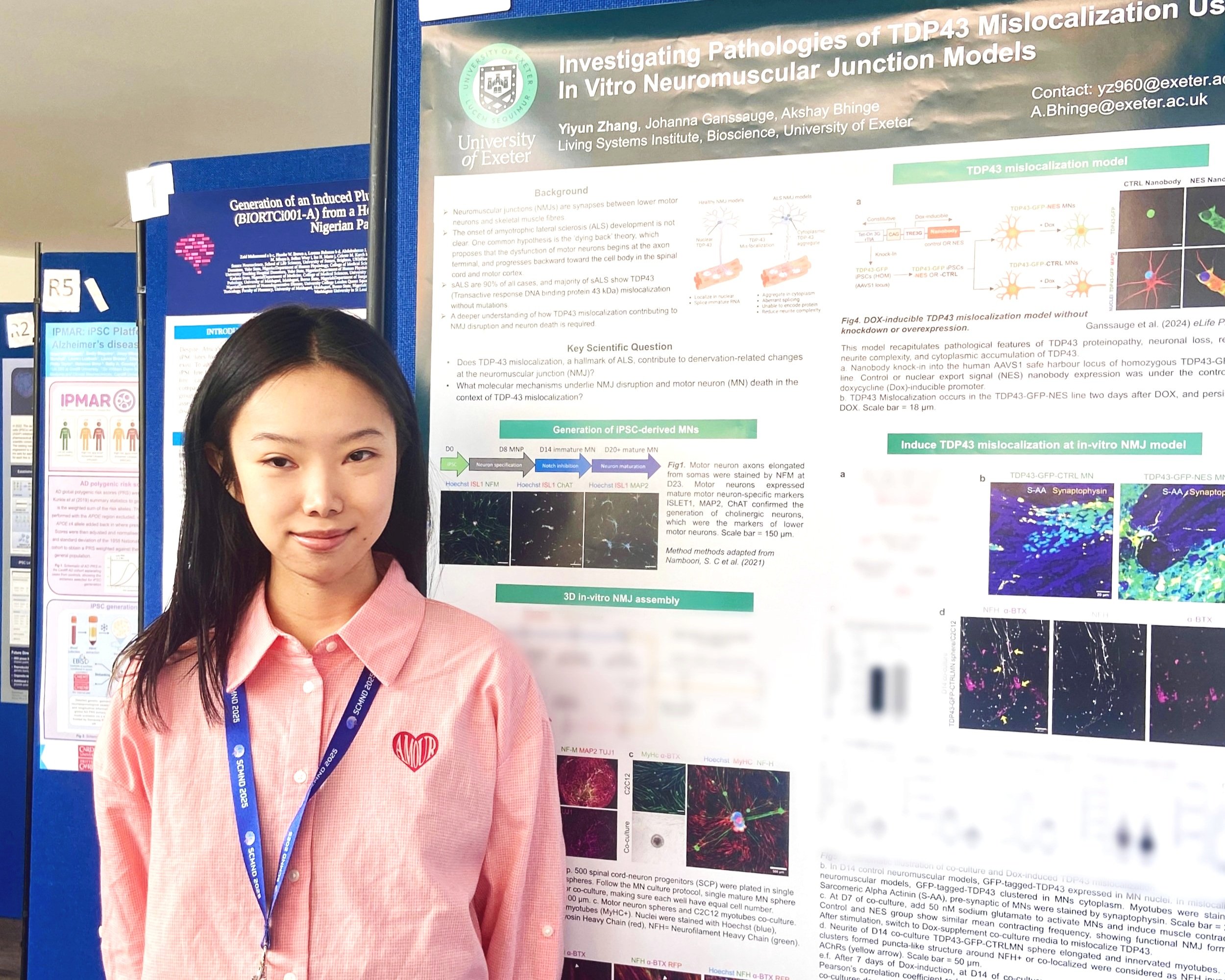 Aileen Zhang awarded the poster prize at the Exeter Brain Conference for her winning work titled "Investigating Pathologies of TDP-43 Mislocalization Using In Vitro Neuromuscular Junction (NMJ) Models", Exeter, 2025