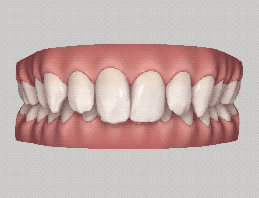 Clincheck Simulation