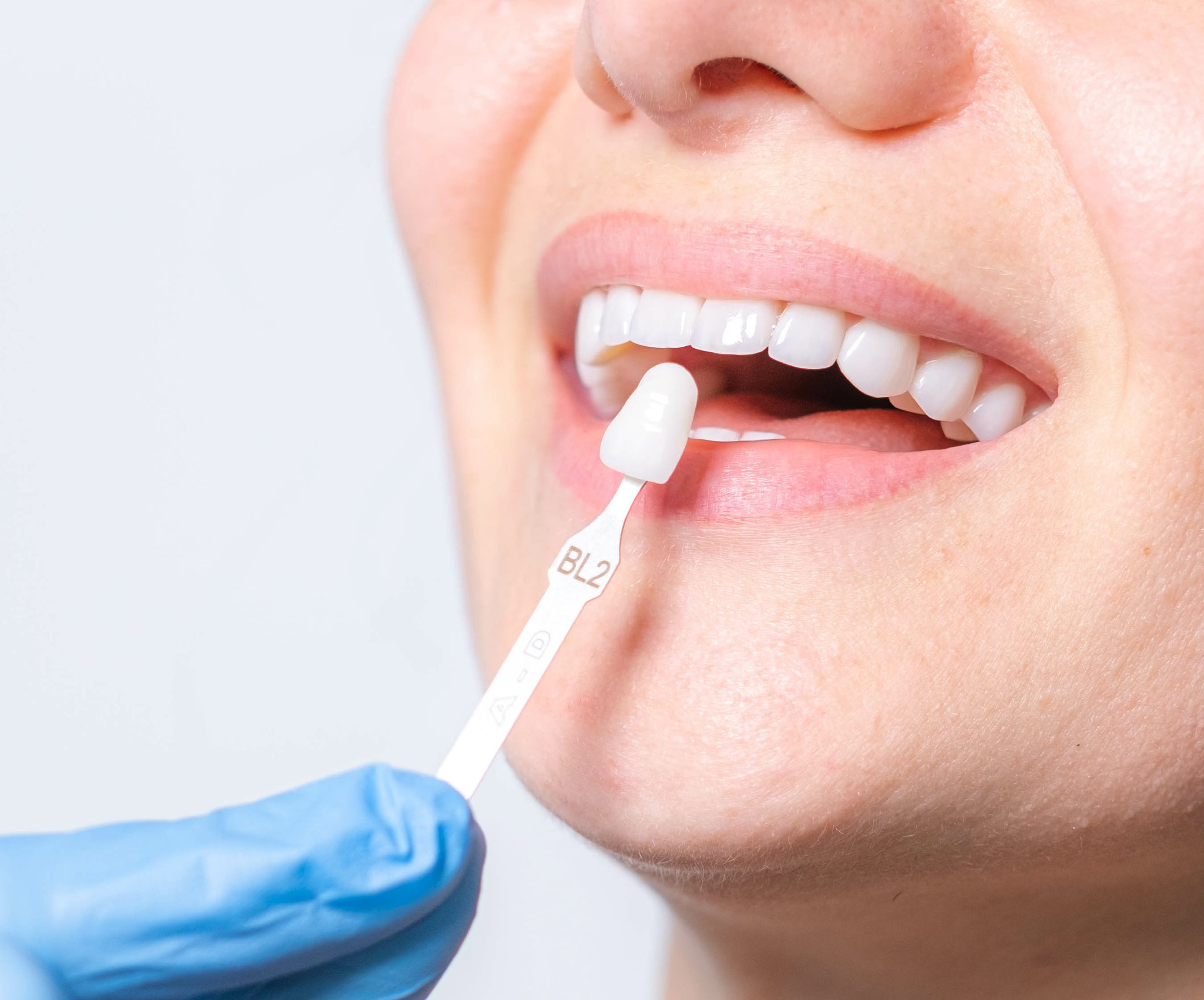 clean white teeth at Dental Smiles Flagstaff