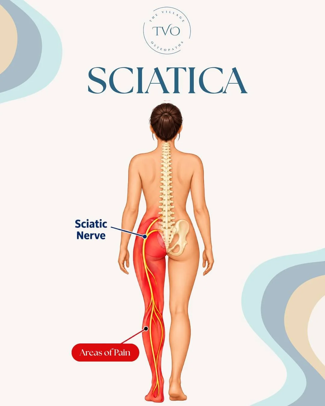 Why Does Back &amp; Leg Pain Feel Worse at Night? 
🌙 If your nerve pain (lumbar radiculopathy) flares up when you hit the pillow, you're not alone. It can be super frustrating, but here is what is actually going on:  Fluid &amp; Inflammation Build-U