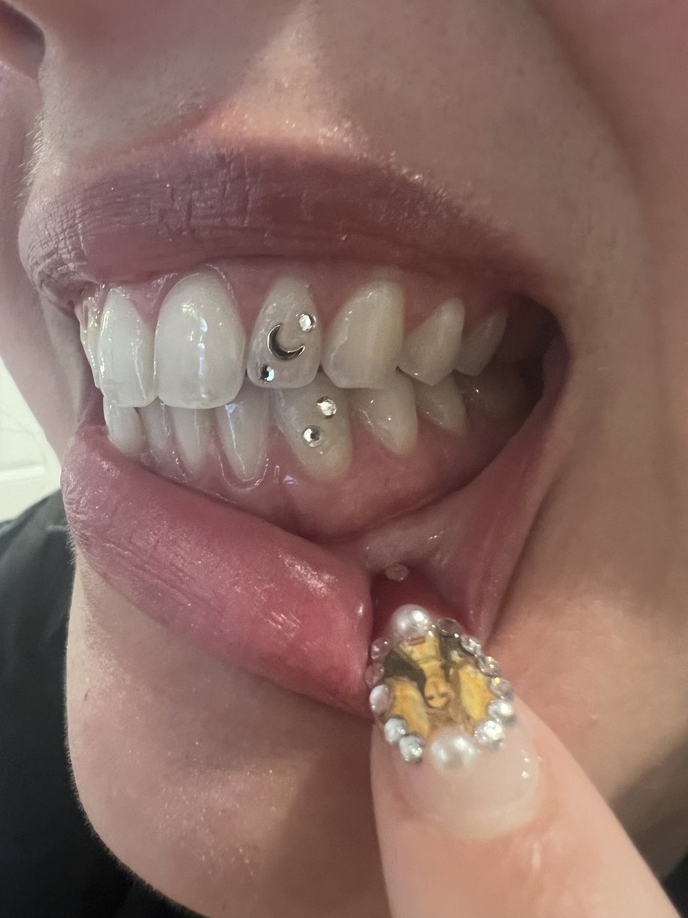Advanced Tooth Gem Class - In Person (Enroll before March 2024)