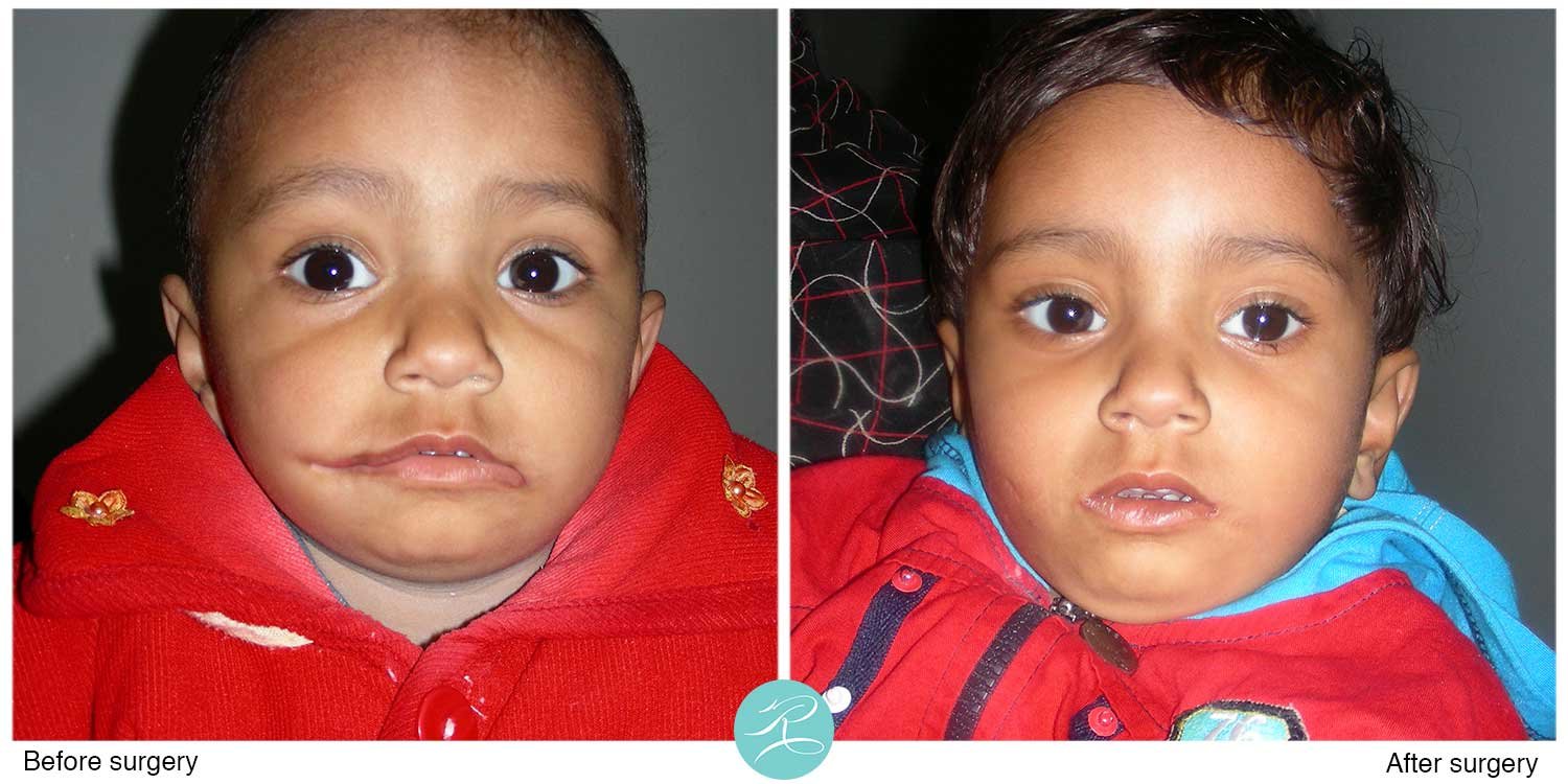 Muhammad-Riaz-Before-and-After3.jpg