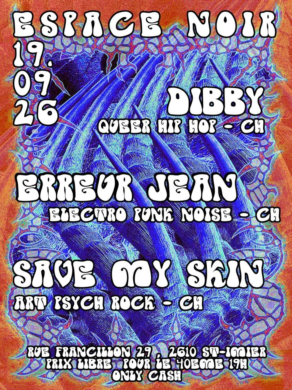 Save my Skin + Dibby + Erreur Jean