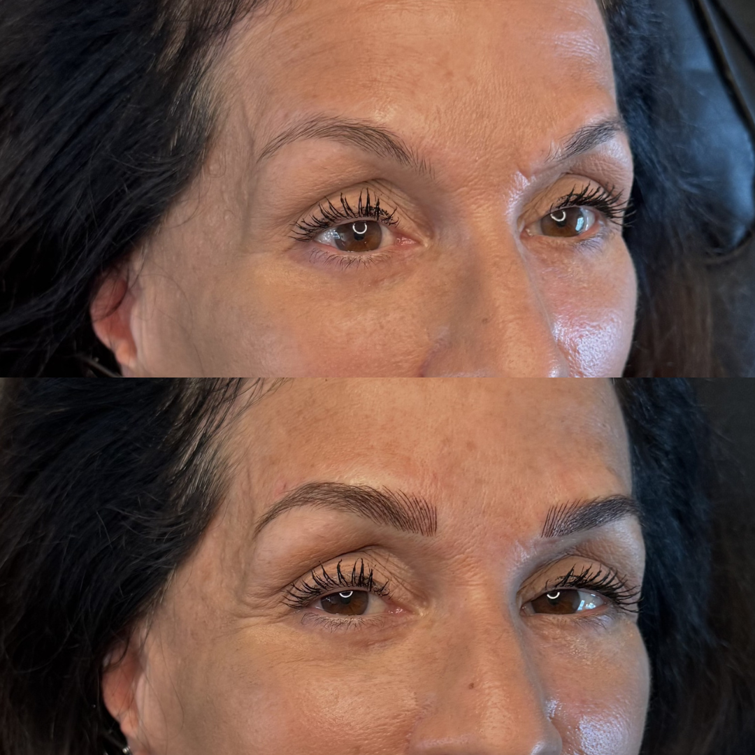 MICROBALDING BEFORE AND AFTER, USE THIS.png