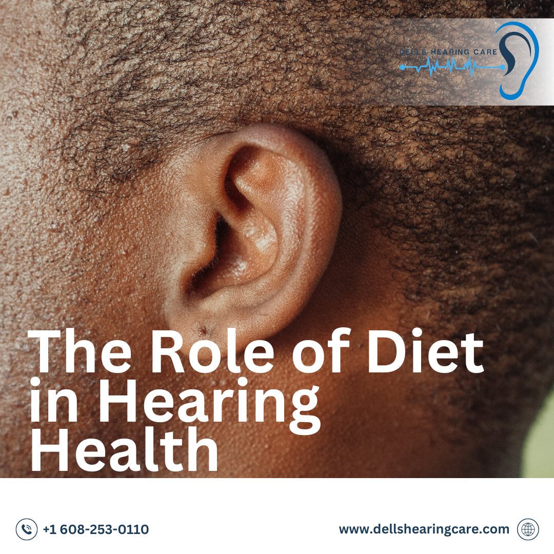 Your diet can significantly influence your hearing health. Nutrients like omega-3 fatty acids, antioxidants, and folic acid are essential for maintaining good hearing. Foods such as fish, leafy greens, nuts, and berries are particularly beneficial. T